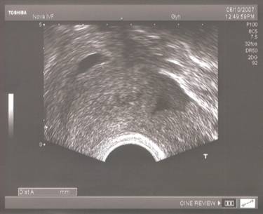 ultrasound-_2_resized.jpg