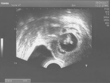 ultrasound-_3_resized.jpg